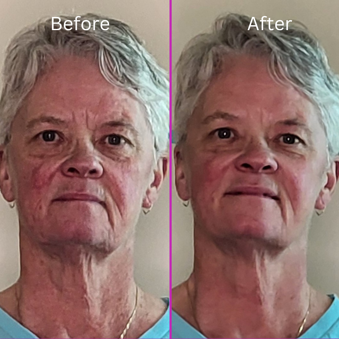 ybtTransformations 2