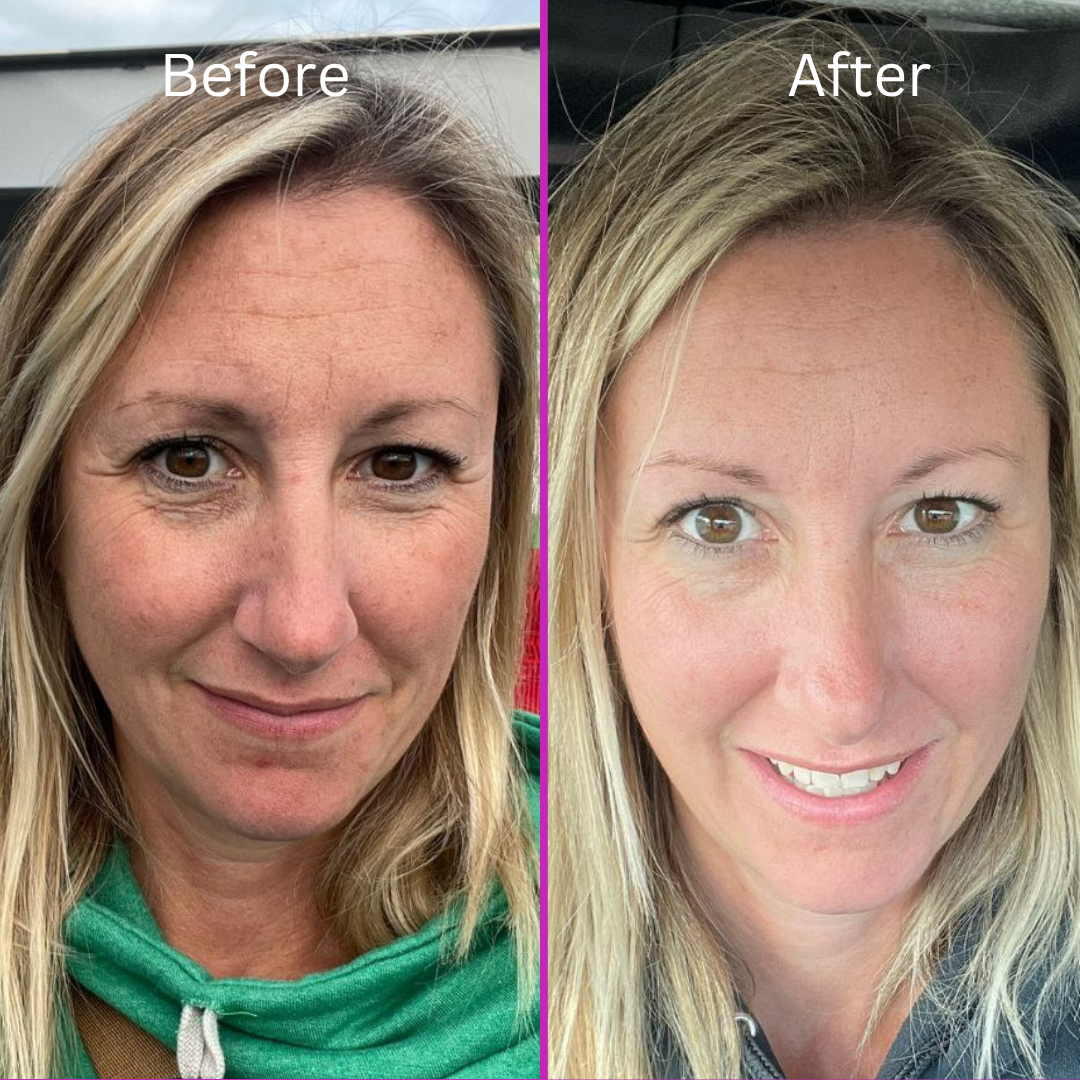 ybtTransformations 3 Stasi Younger By Tonight Before & After Photo